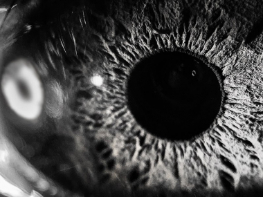 Превью публикации От первого лица: атрофия зрительного нерва